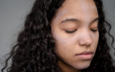 Haloskin Lab Acne Fighting Package: Jerawat Pergi Nggak Datang Lagi!